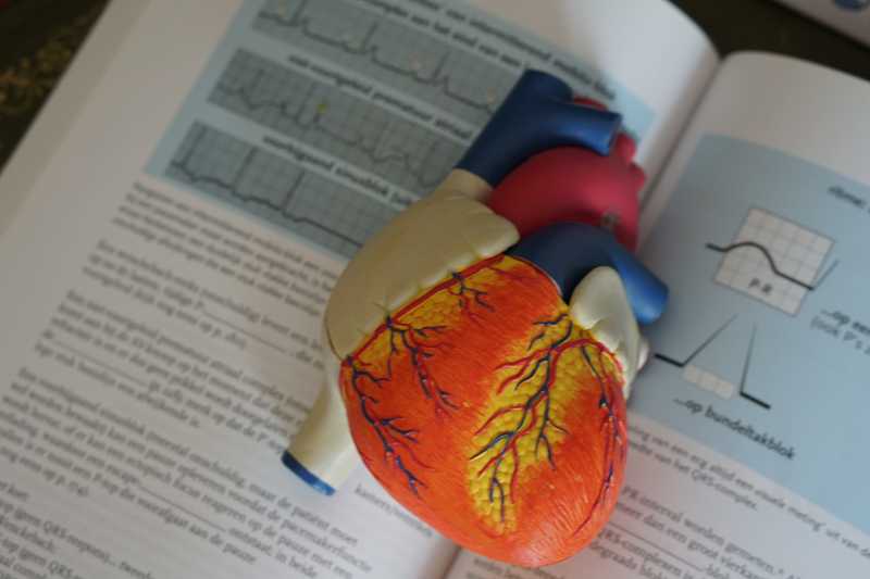 Anatomy of a heart